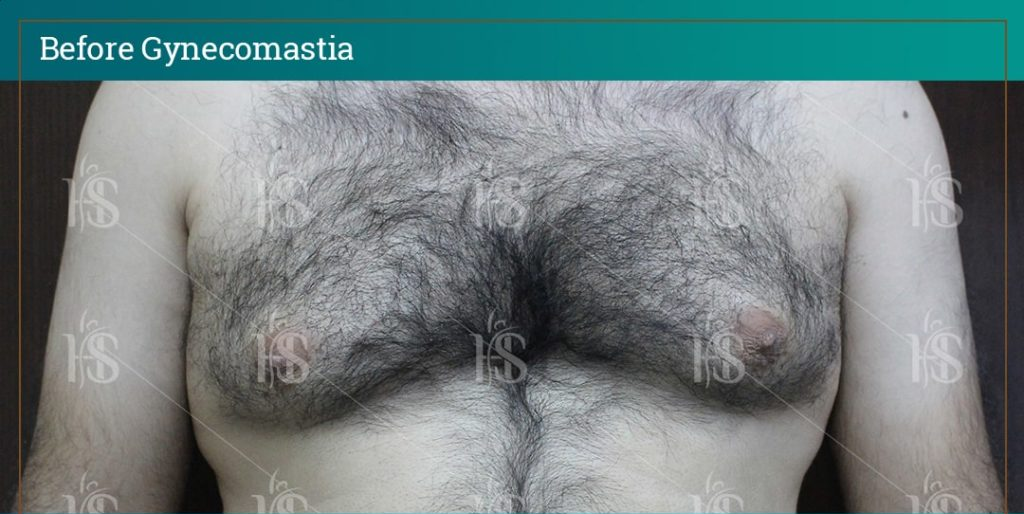 111-min-1024x1024-1 1