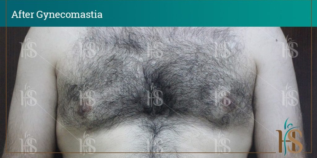 111-min-1024x1024-1 2