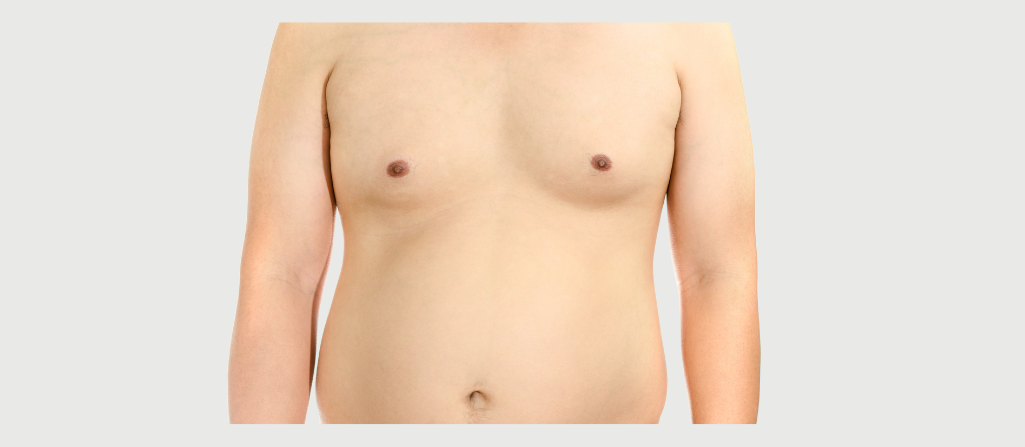 Puffy Nipples in Men, How to Get Rid of Man Boobs, Gynecomastia, Chest Fat