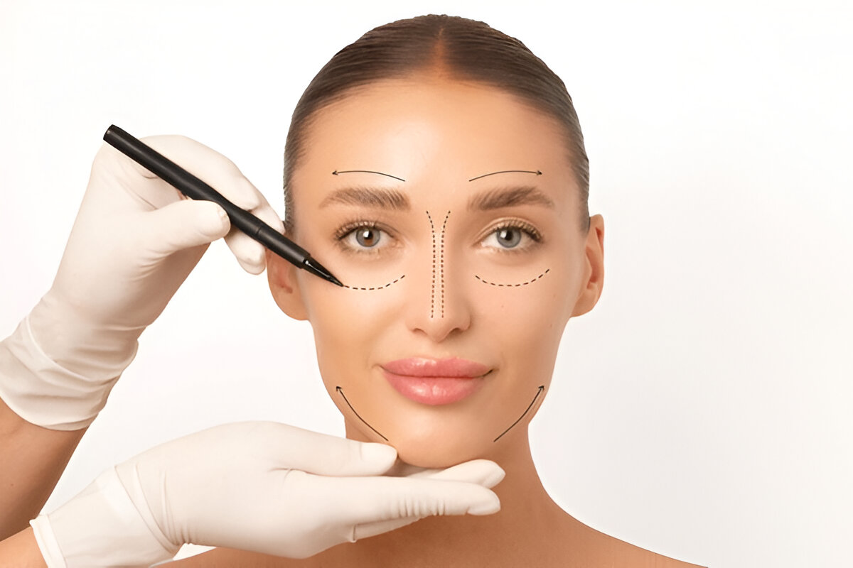deep plane facelift Dubai