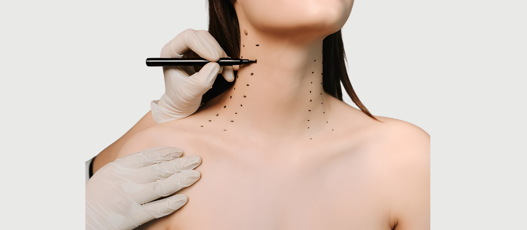 neck lift treatment in Dubai