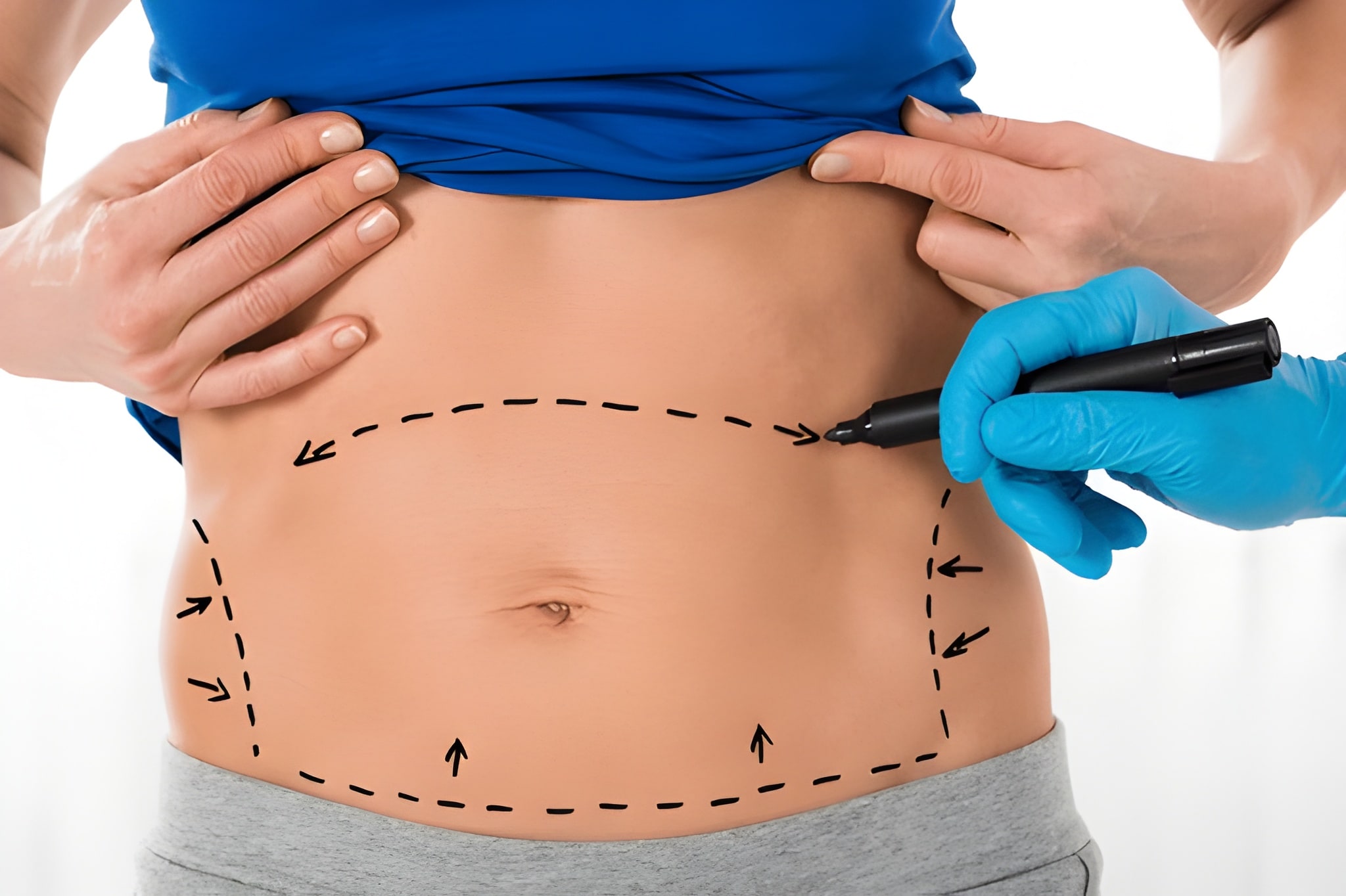 warning signs after tummy tuck